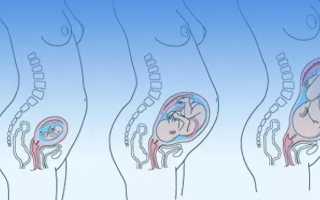 Понос при беременности во втором триместре