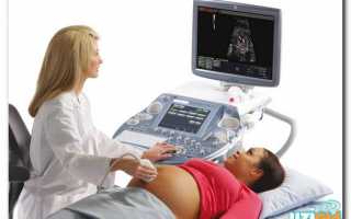 Зачем назначают при беременности доплер УЗИ?