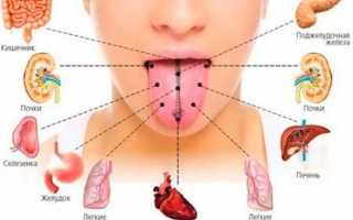 Металлический запах железа изо рта