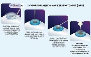 Восстановление зрения в домашних условиях — комплекс упражнений для глаз