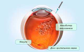 Макула сетчатки глаза: как избежать различных патологий