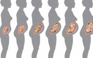 Понос в первом триместре беременности