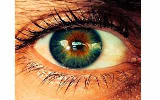 Глаза разного цвета – как называется патология