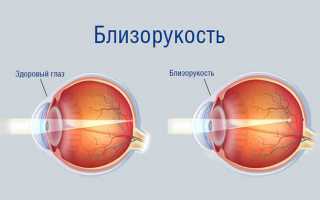 Могут ли очки навредить зрению: правильно выбираем оптику при близорукости, дальнозоркости и без диоптрий