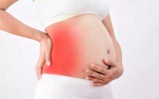 Болит левый бок внизу живота при беременности