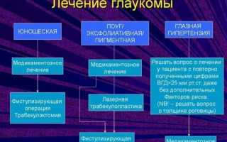 Глаукома: причины, симптомы и лечение в Екатеринбурге