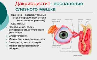 Глазные и ушные капли Ципрофарм: инструкция по применению, цена, аналоги и отзывы