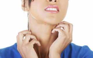 Зуд кожи тела при заболеваниях печени