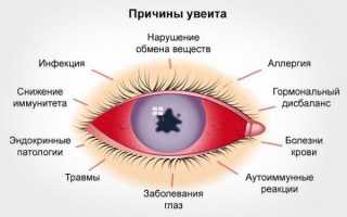 Увеит (воспаление сосудистой сетки глаза): фото, симптомы и лечение