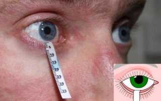 Все о синдроме сухого глаза или как побороть надоедливый симптом