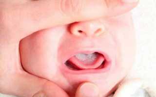У ребенка болит язык и температура