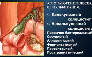 Температура при холецистите