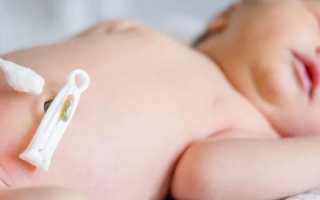 Как избавить новорожденного от икоты