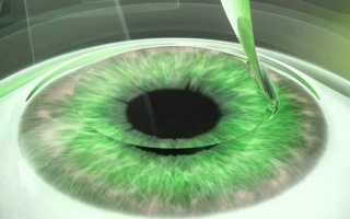 Как можно восстановить плохое зрение: доступные способы и методы лечения