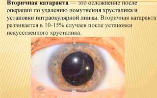 Что из себя представляет искусственный хрусталик глаза — ТОП-3 производителей